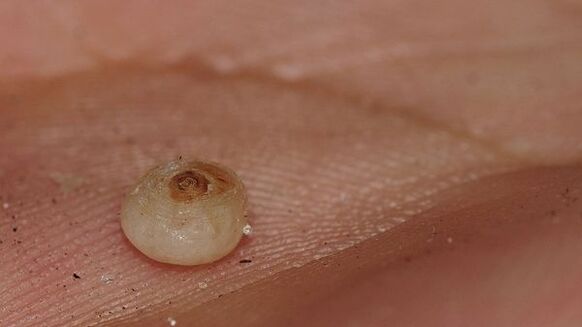 Sarkopsillose mit subkutanen Parasiten